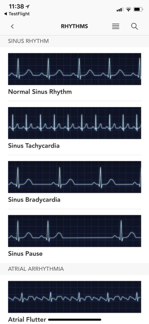 Instant ECG: An Electrocardiogram Rhythms Guide