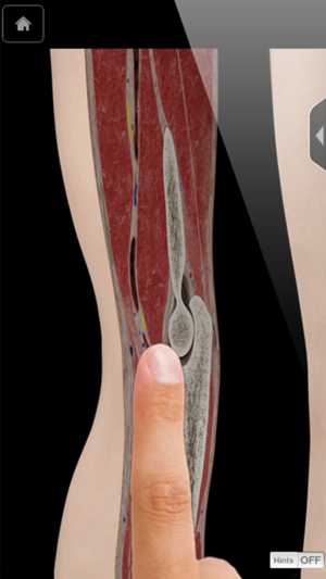 Elbow Pro III - iPhone Edition